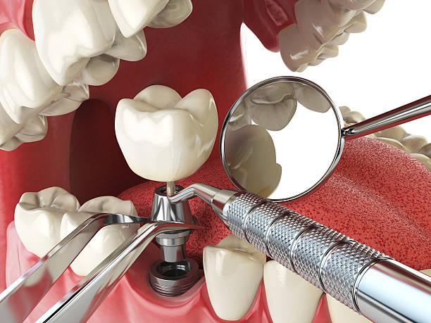Best Walk-In Emergency Dental Services in Shenandoah Farms, VA