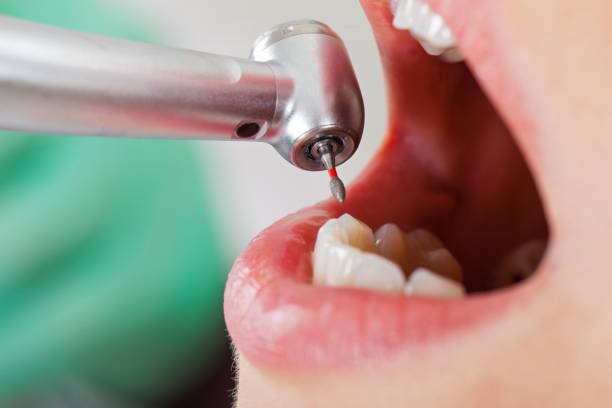 Best Emergency Cosmetic Dentistry (e.g., broken veneers) in Shenandoah Farms, VA